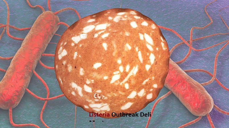 Listeria